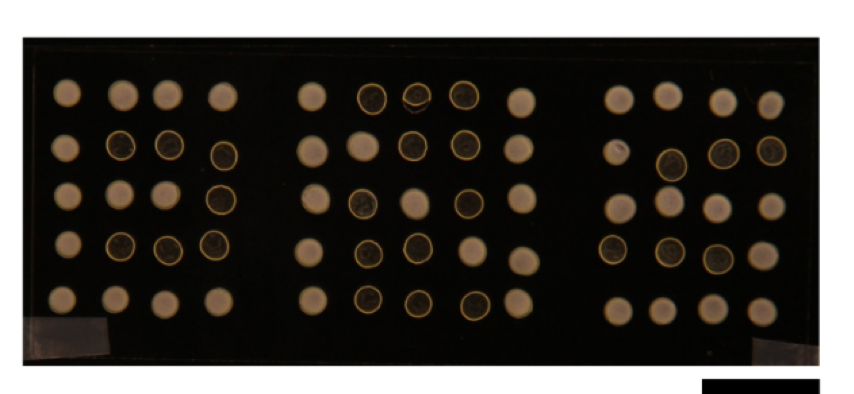 Harnessing coffee rings: from ubiquitous particle patterning to low-cost diagnostics