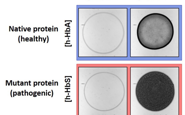 Protein mutation probed by the Coffee-Ring Effect and published in JACS!