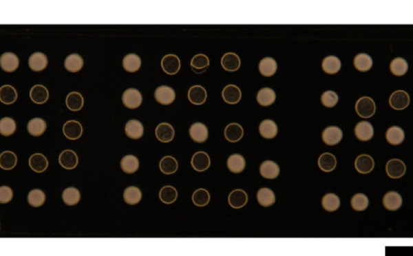 Harnessing coffee rings: from ubiquitous particle patterning to low-cost diagnostics