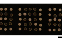 Harnessing coffee rings: from ubiquitous particle patterning to low-cost diagnostics